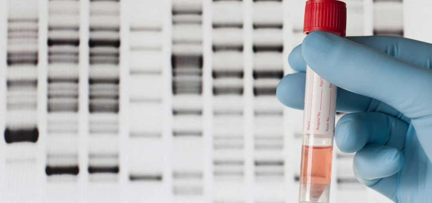 DNA Testing and the Importance of Your Will in Estate Planning